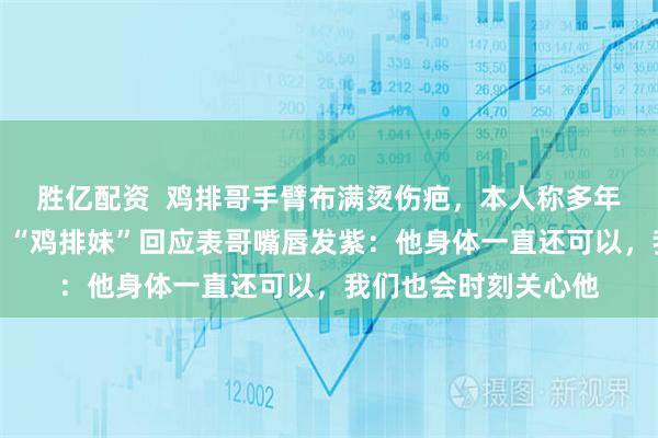 胜亿配资  鸡排哥手臂布满烫伤疤，本人称多年炸鸡排，很难避免；“鸡排妹”回应表哥嘴唇发紫：他身体一直还可以，我们也会时刻关心他